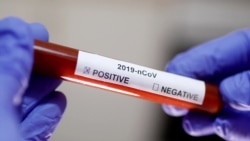 Sin agua y sin jabón en Cuba en medio del coronavirus Sin agua y sin jabón en Cuba en medio del coronavirus